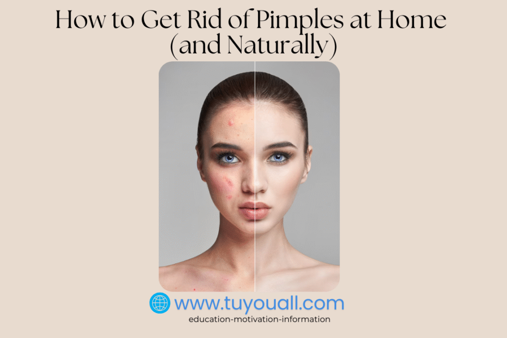 How to Get Rid of Pimples at Home (and Naturally)
