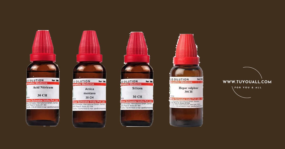 Homeopathic Treatment for Anal Fistula Combibation 1