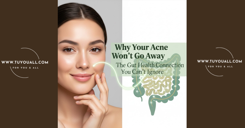 Why Your Acne Won't Go Away: The Gut Health Connection You Can't Ignore